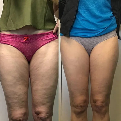 Before and after results