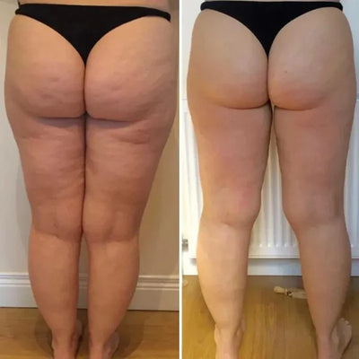 Before and after results
