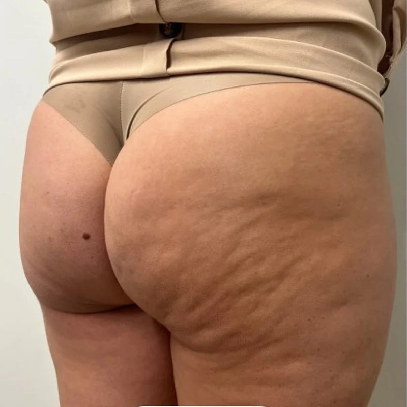 After image